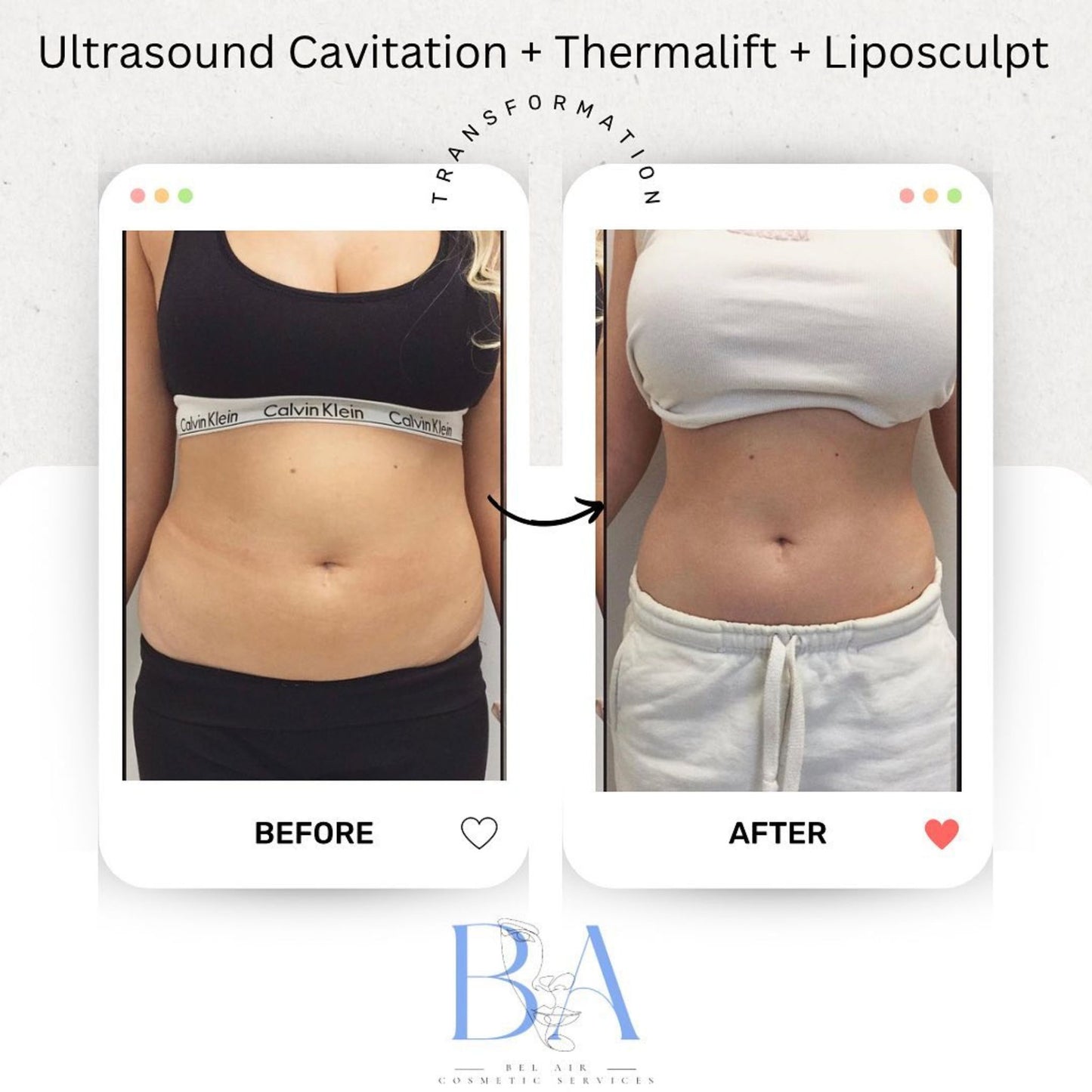 Ultimate Sculpting & Tightening Bundle