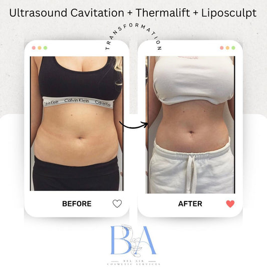 Ultimate Sculpting & Tightening Bundle